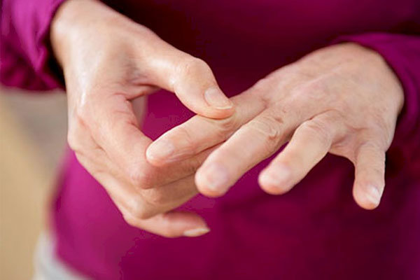 تغییرات هورمونی ممکن است باعث ایجاد آرتریت روماتوئید در زنان شود - خبرگزاری مهر | اخبار ایران و جهان