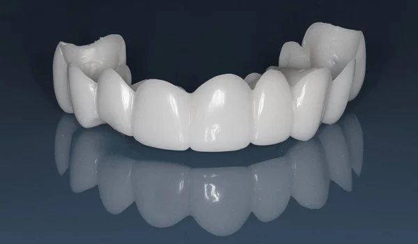 How to use removable laminate teeth