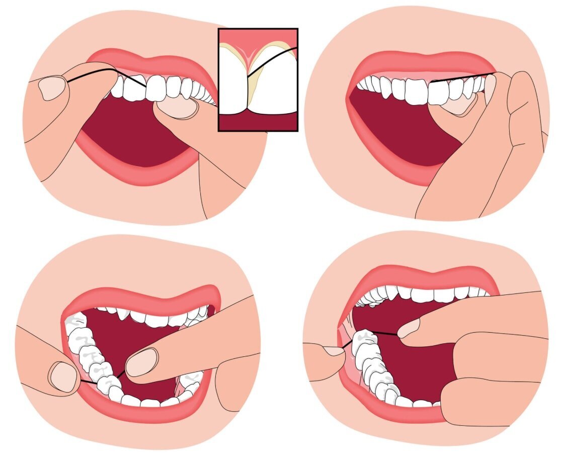 ۵ فایده نخ دندان/ چطور درست از نخ دندان استفاده کنیم؟