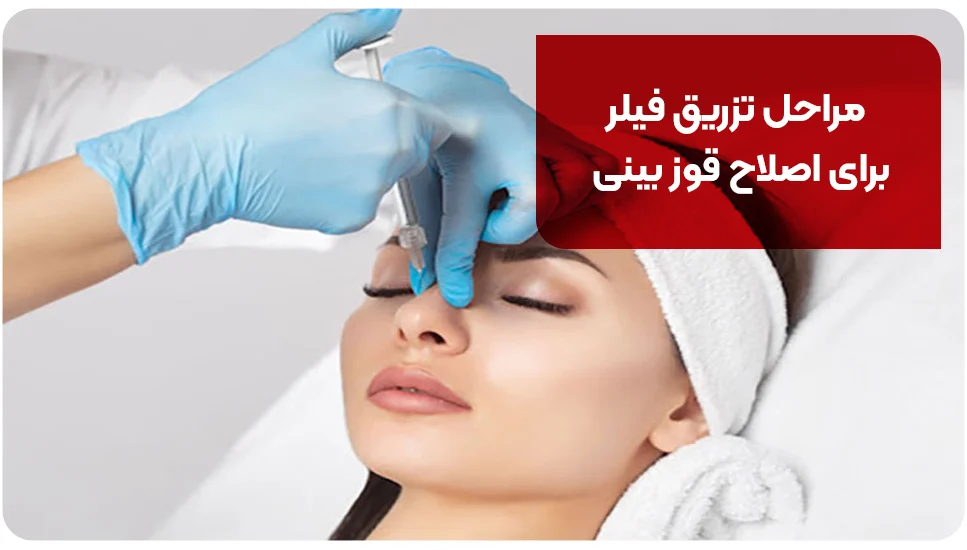 مراحل تزریق فیلر برای اصلاح قوز بینی